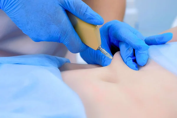 Doktor karbondioksit enjekte ediyor. Hasta karnına karbondioksit tedavisi uyguluyor..