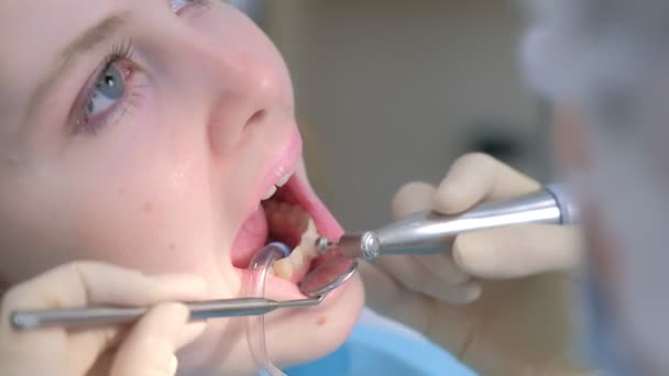 Jonge vrouw op hygiënische reiniging elektrische tandenborstel van tanden in de tandheelkunde. — Stockvideo