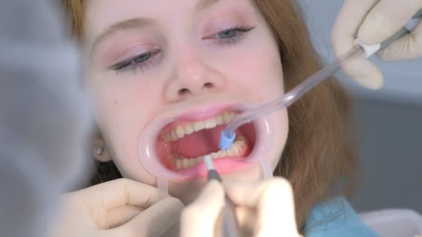 Patient woman on hygienic cleaning of teeth procedure in dentistry by dentist. — Stock Video