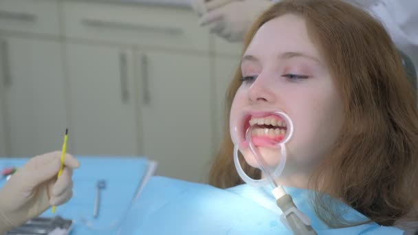 Ortodoncista preparando los dientes de las mujeres en la odontología antes de aparatos ortopédicos instalación. — Vídeo de stock
