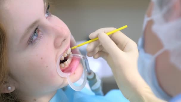 Orthodontist bedekken speciale gel op vrouwelijke tanden in de tandheelkunde met behulp van borstel. — Stockvideo