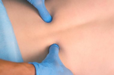 Eldivenli adam, kadını akupunktur için hazırlıyor. Sırtına masaj yapıyor..