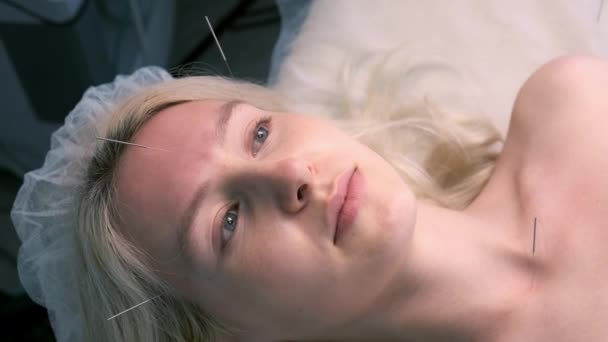 Traitement d'acupuncture avec aiguilles insérées sur le visage et le cou des femmes, gros plan. — Video