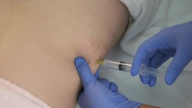 Doktor ozon terapisinde hastanın karnına ozon gazı enjekte ediyor..