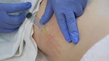 Doktor ozon terapisinde kadın vücuduna ozon gazı enjekte ediyor..