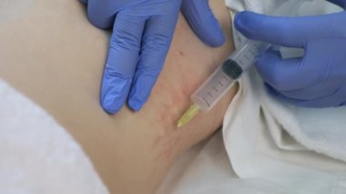 Doktor ozon terapisinde kadın vücuduna ozon gazı enjekte ediyor..