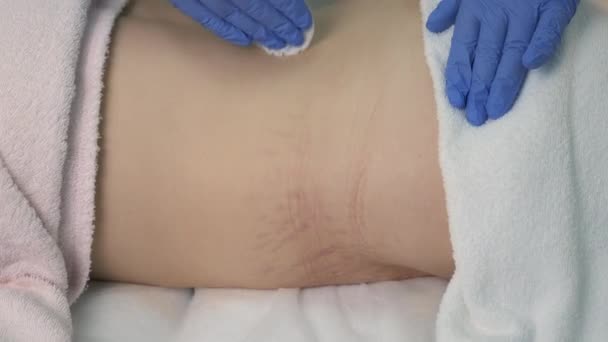 우주 과학 클리닉에서 여성의 몸에 붙어 있는 장기들을 제거하고 있는 의사. — 비디오