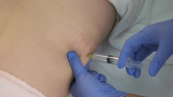 Médecin fait injection de gaz d'ozone dans l'abdomen du patient sur le côté sur la thérapie de l'ozone. — Video