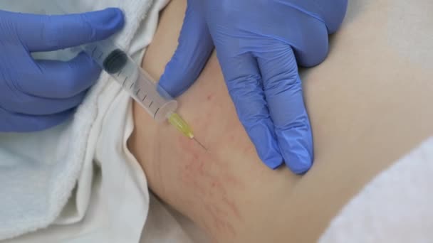 Médecin fait injection de gaz d'ozone dans le corps de la femme sur le côté sur la thérapie de l'ozone. — Video