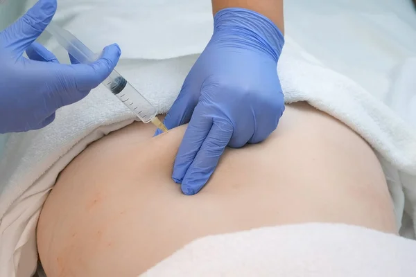 Doctor makes injection of ozone gas in woman back against stretches on therapy.
