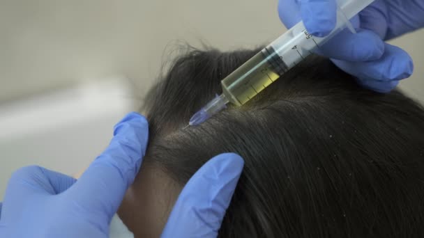Lekarz trycholog wykonuje zastrzyki w głowę kobiety dla wzrostu włosów. — Wideo stockowe