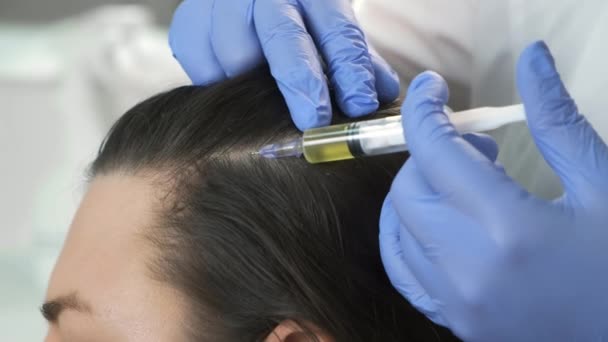 Врач-трихолог делает инъекции женской коже на голове для роста волос. — стоковое видео
