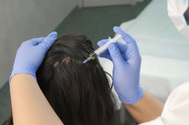Doktor trikoloğu saç büyümesi için kadın derisine iğne yapıyor..