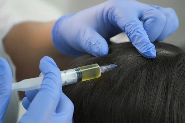 Arzt Trichologe macht Injektionen in Frauenhaut am Kopf für Haarwachstum. — Stockfoto