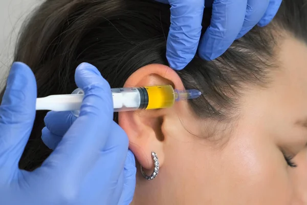 医師トリコロジストは髪の成長のために頭の上の女性の皮膚に注射を行います. — ストック写真