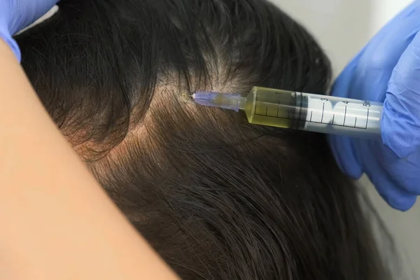 Doctor trichologist makes injections in womans skin on head for hair growth. Stock Photo