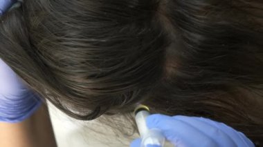Doktor trikoloğu saç büyümesi için kadın derisine iğne yapıyor..
