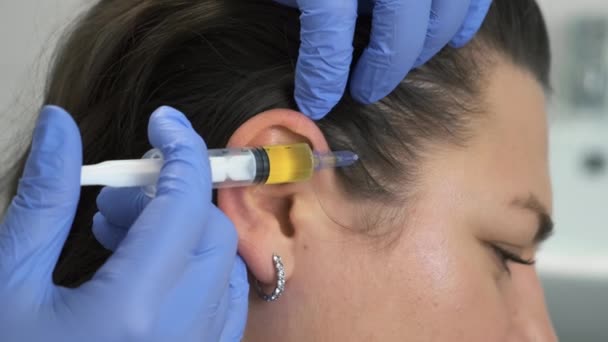 Doctor trichologist makes injections in womans skin on head for hair growth. — Stock Video