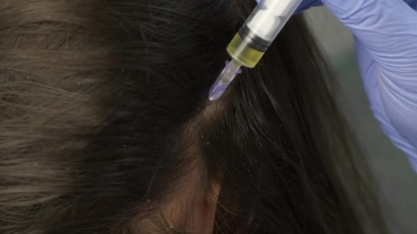 Läkare tricholog gör injektioner i kvinnors hud på huvudet för hårväxt. — Stockvideo