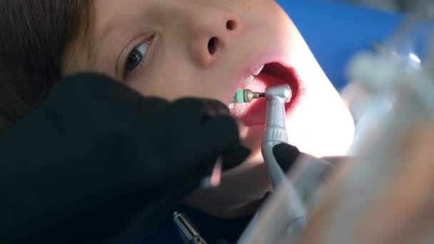 Гигиенист-стоматолог проводит гигиеническую чистку полости рта в стоматологии для подростка. — стоковое видео