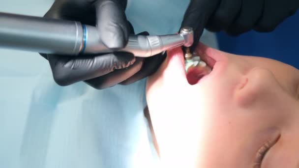 치과 의사가 십 대 소년의 치 과를 구강 위생적으로 청소하는 모습. — 비디오