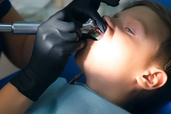 치과 의사가 십 대 소년의 치 과를 구강 위생적으로 청소하는 모습. — 스톡 사진
