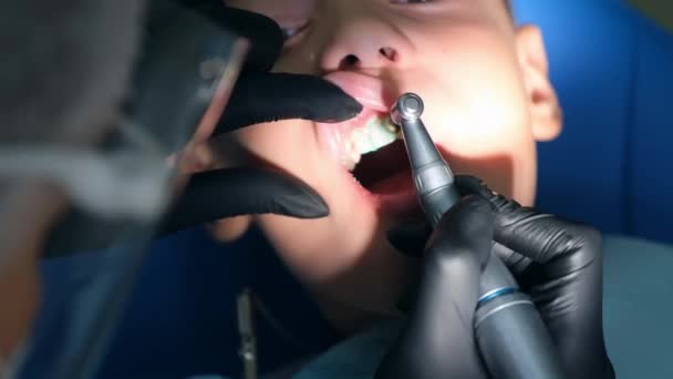 Igienista dentista che fa pulizia igienica orale in odontoiatria per ragazzo adolescente. — Video Stock