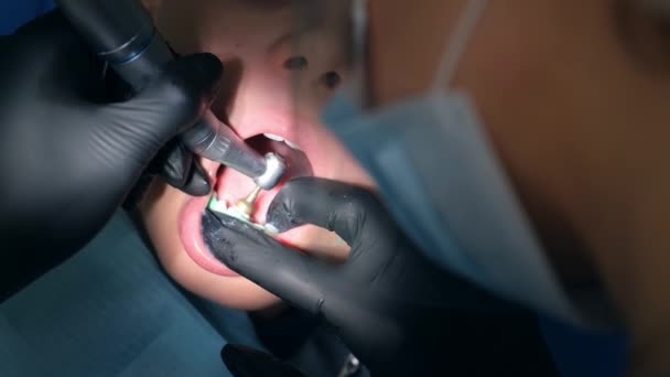 Dişçi hijyenik diş temizliği yapıyor. Çocuk için diş hekimliği yapıyor.. — Stok video