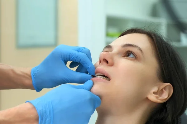 Orthodontist arts controleert het sluiten van de vrouwelijke tanden met behulp van carbon papier. — Stockfoto