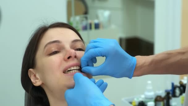 Médico ortodoncista comprueba el cierre de los dientes de la mujer con papel de carbono. — Vídeo de stock