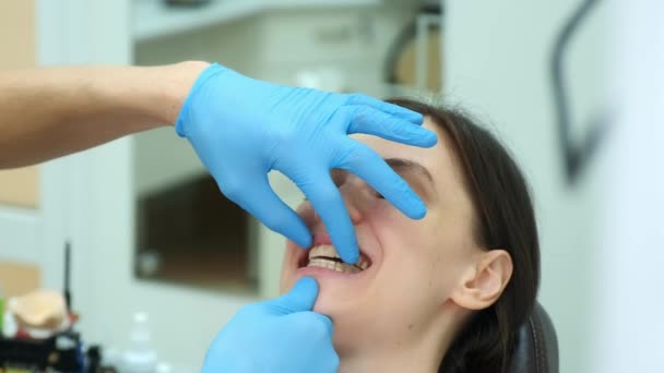 Médico ortodoncista comprueba el cierre de los dientes de la mujer con el entrenador de silicona. — Vídeo de stock