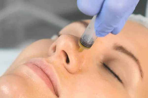 Cosmetoloog is het aanbrengen van gele peeling op vrouwen gezicht met behulp van spuit. — Stockfoto