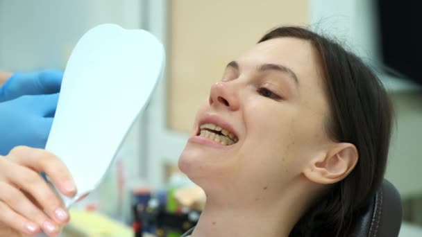 Médico ortodoncista comprueba el cierre de los dientes de la mujer con papel de carbono. — Vídeos de Stock