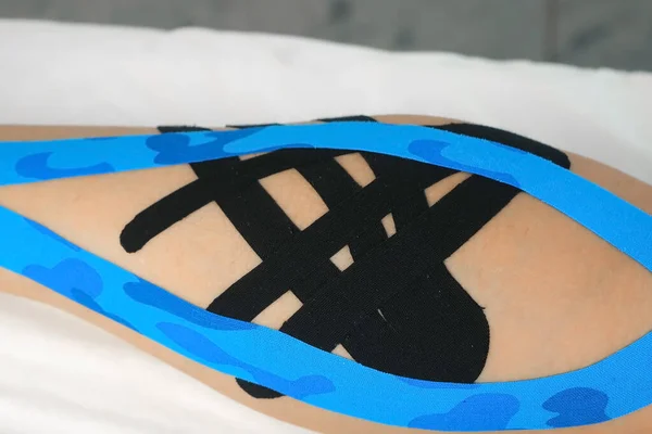Kinesiologi band på kvinnors ben för att fixa vadmuskeln, närbild. — Stockfoto