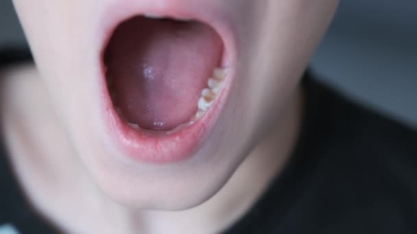 Babyzahn im Mund eines zehnjährigen Jungen, den er mit dem Finger schwingt, Nahaufnahme. — Stockvideo