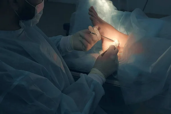 Хірург робить операцію з видалення гігроми щиколотки в лікарні в операційній . — стокове фото