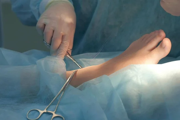 Хірург вишиває щиколотку на нозі під час хірургічного втручання самопоглинаючими нитками . — стокове фото
