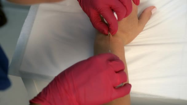 Cosmetoloog is het maken van injectie op vrouwen handen te contouren met vulstoffen. — Stockvideo