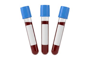 Üzerinde beyaz etiket olan üç kan tüpü gösteriliyor. Tüpler kırmızı ve mavi.