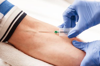 The nurse draws blood from a vein for test. clipart