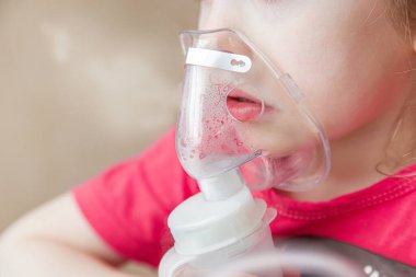 Üç yaşındaki küçük kız çocuğu - dört yaşında hasta, nebulizör tedavisi görüyor, öksürüyor. bronşit tedavisi