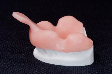 Diş protezleri üretim süreci