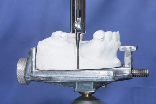Виробничий процес стоматологічних протезів — стокове фото