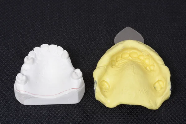 Proceso de fabricación de prótesis dentales — Foto de Stock