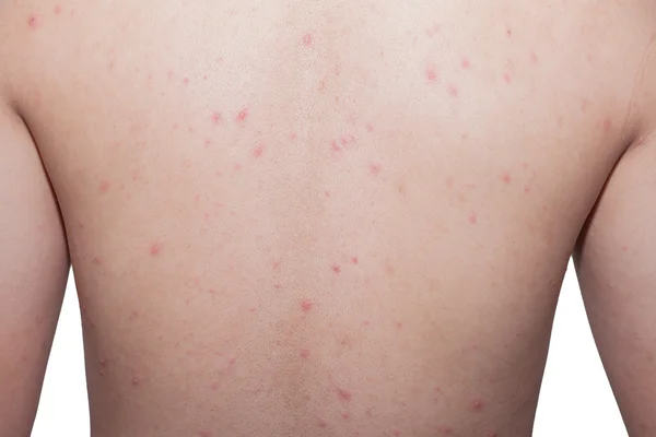 su çiçeği geri görüntülemek.