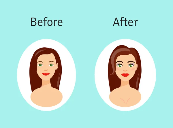 Cirugía plástica antes y después de la ilustración vectorial. Retrato de hermosa chica en estilo de dibujos animados . — Vector de stock