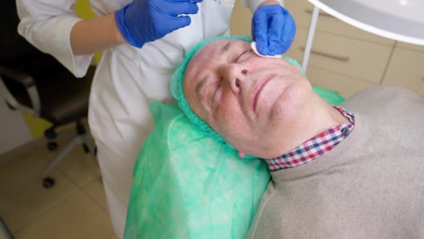Cosmetoloog veegt bloed uit het gezicht van haar volwassen man client na anti-aging injecties tijdens biorevitalisatie — Stockvideo