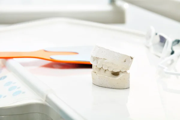 Сідло протеза в стоматологічній лабораторії . — стокове фото
