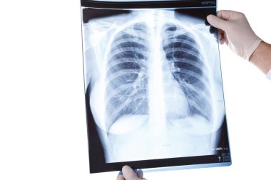 Doktor eldiven takıyor, göğüs röntgenine bakıyor, yakın plan, Covid-19.