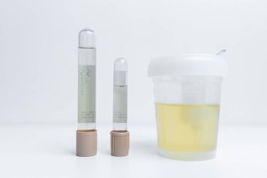 Espoo 'da. Finlandiya. 06 Mayıs 2021 Tıbbi tüplerde idrar testi